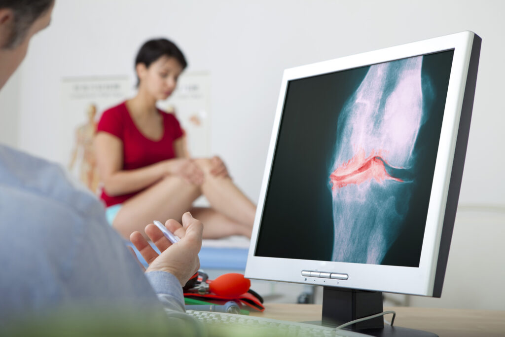 Osteoarthritis Treatments